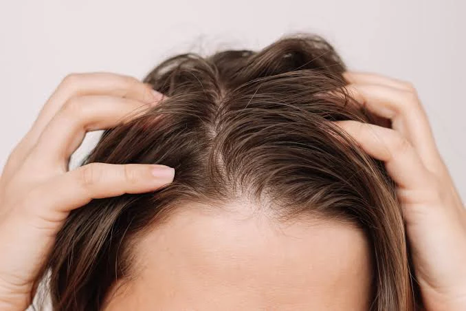 Oily & itchy scalp
